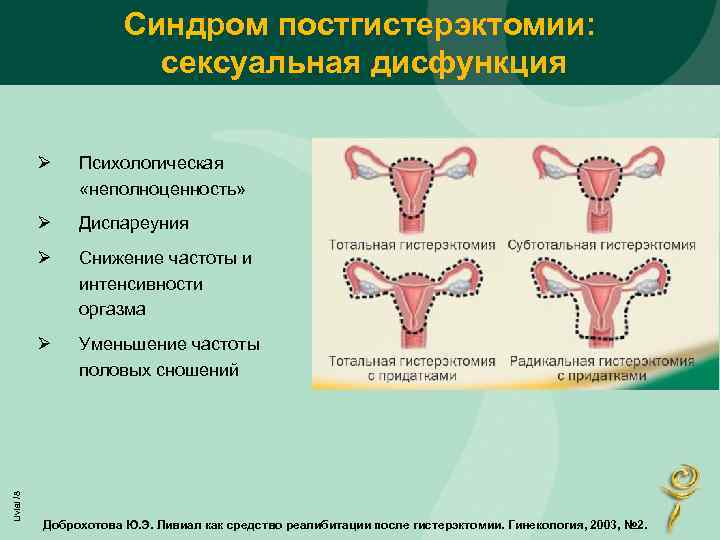 Синдром постгистерэктомии: сексуальная дисфункция Психологическая «неполноценность» Ø Диспареуния Ø Снижение частоты и интенсивности оргазма