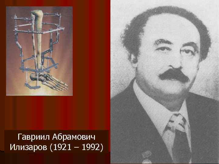 Гавриил Абрамович Илизаров (1921 – 1992) 