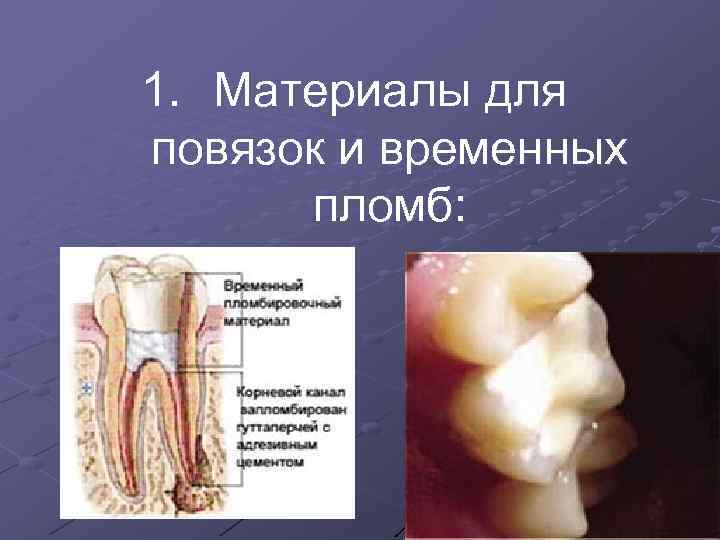 1. Материалы для повязок и временных пломб: 