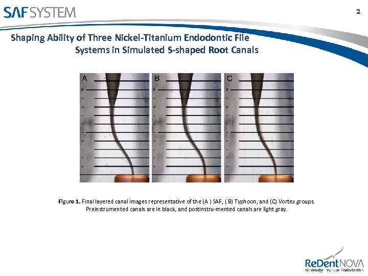 2 Shaping Ability of Three Nickel-Titanium Endodontic File Systems in Simulated S-shaped Root Canals
