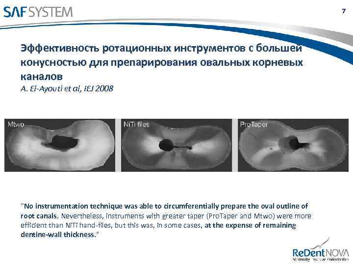 7 Эффективность ротационных инструментов с большей конусностью для препарирования овальных корневых каналов A. El-Ayouti