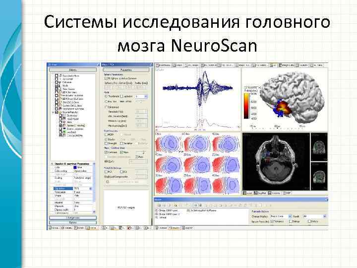 Системы исследования головного мозга Neuro. Scan 