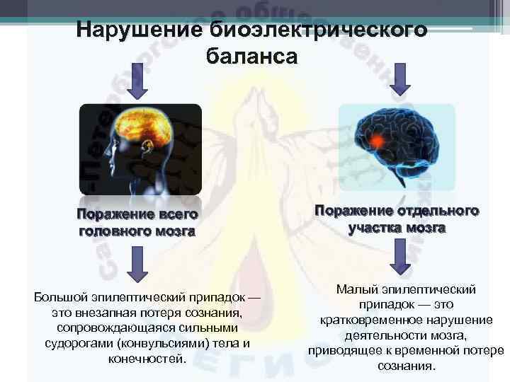 Нарушение биоэлектрического баланса Поражение всего головного мозга Большой эпилептический припадок — это внезапная потеря