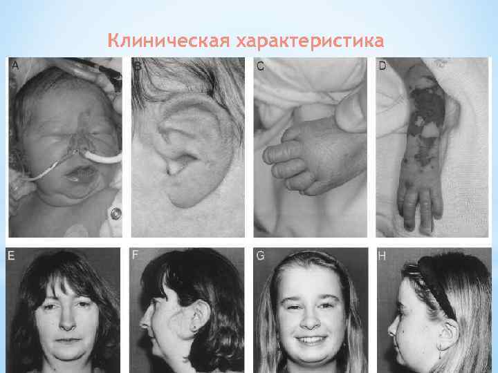 Клиническая характеристика 