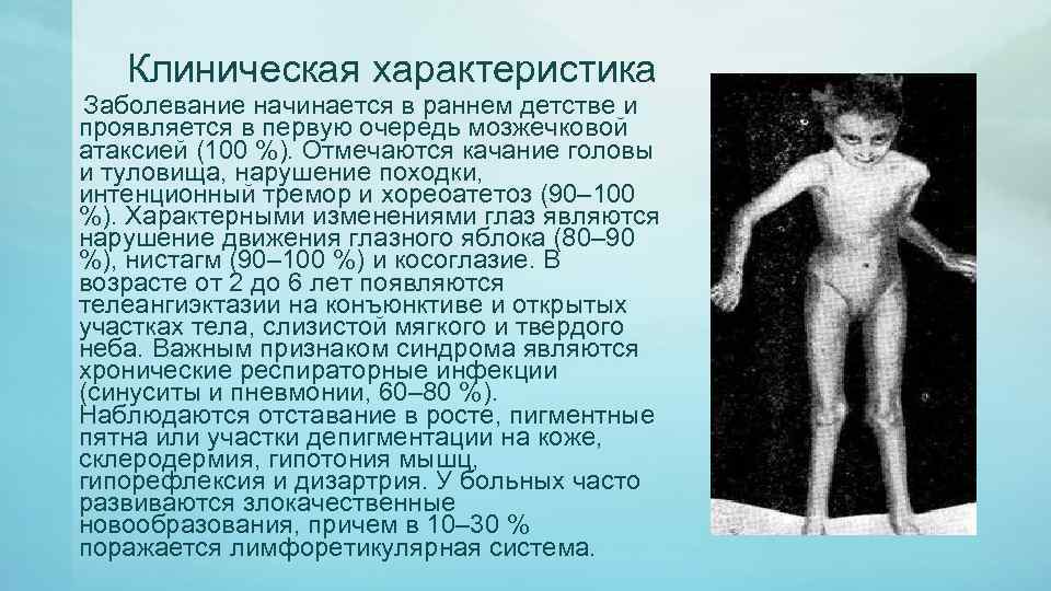 Клиническая характеристика Заболевание начинается в раннем детстве и проявляется в первую очередь мозжечковой атаксией