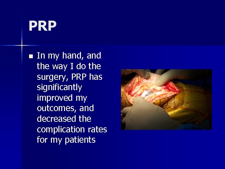 PRP n In my hand, and the way I do the surgery, PRP has