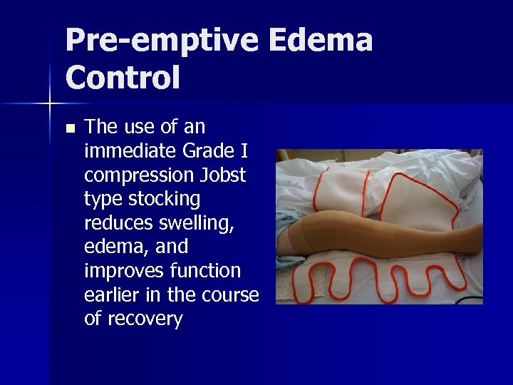 Pre-emptive Edema Control n The use of an immediate Grade I compression Jobst type