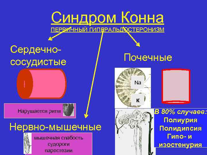 Синдром Конна ПЕРВИЧНЫЙ ГИПЕРАЛЬДОСТЕРОНИЗМ Сердечнососудистые Почечные Na к Нарушается ритм Нервно-мышечные мышечная слабость судороги