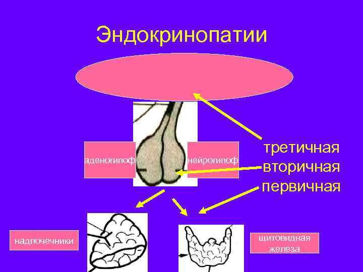 Эндокринопатия что это такое. Эндокринопатия. Первичные и вторичные эндокринопатии.