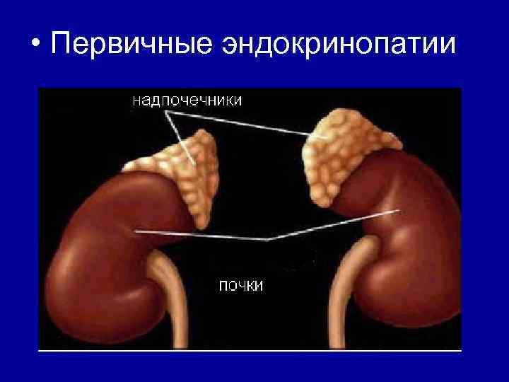  • Первичные эндокринопатии 