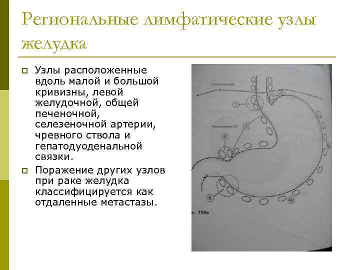 Региональные лимфатические узлы желудка p p Узлы расположенные вдоль малой и большой кривизны, левой