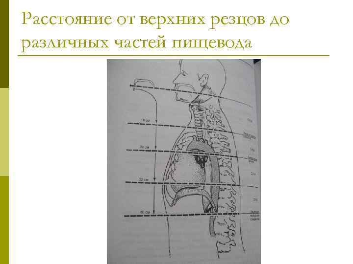 Расстояние от верхних резцов до различных частей пищевода 