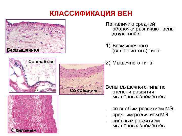 Вена препарат. Вена мышечного типа препарат гистология. Вена безмышечного типа гистология препарат. Вена мышечного типа ubcnjkjub. Вена мышечного типа гистология.