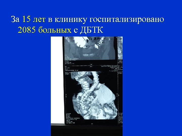 За 15 лет в клинику госпитализировано 2085 больных с ДБТК 