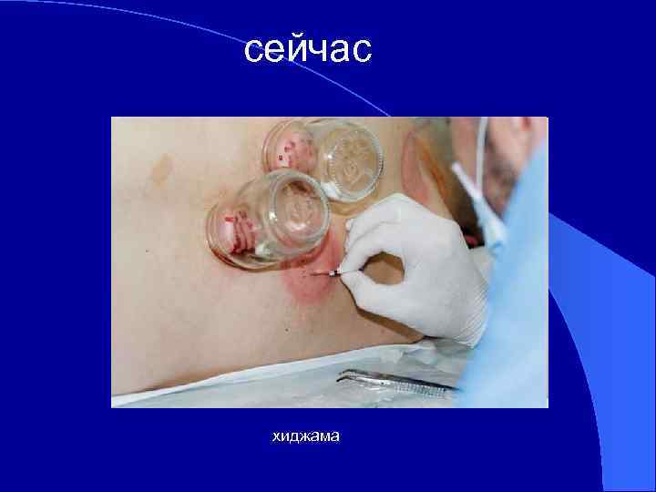 сейчас хиджама 