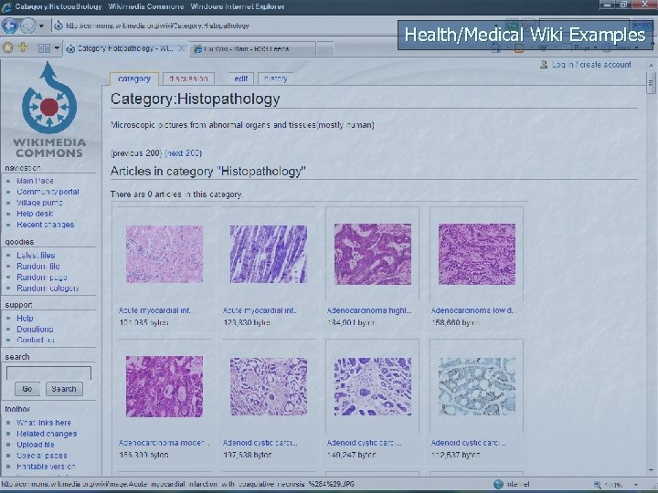 Health/Medical Wiki Examples 