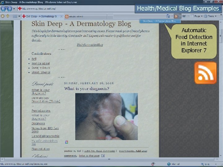 Health/Medical Blog Examples Automatic Feed Detection in Internet Explorer 7 