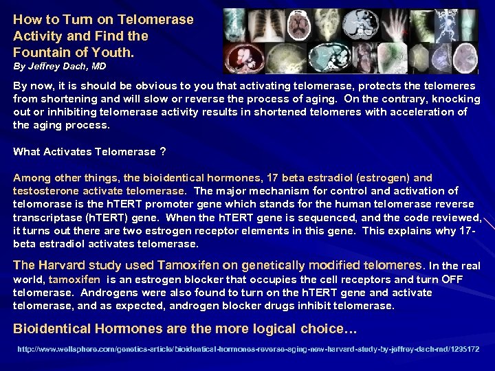 How to Turn on Telomerase Activity and Find the Fountain of Youth. By Jeffrey