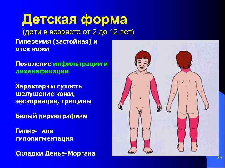 Детская форма (дети в возрасте от 2 до 12 лет) Гиперемия (застойная) и отек