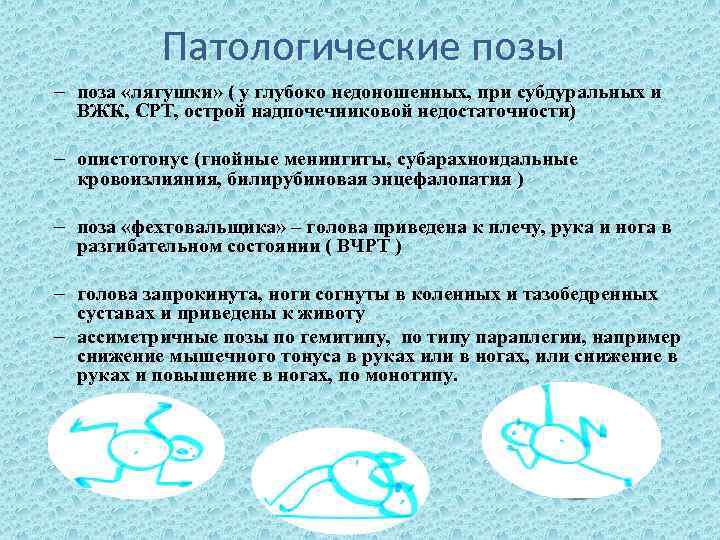 Патологические позы – поза «лягушки» ( у глубоко недоношенных, при субдуральных и ВЖК, СРТ,