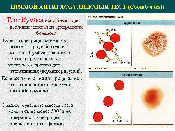 Прямой тест. Антиглобулиновый тест иммунология. Прямой антиглобулиновый тест прямая проба Кумбса. Антиглобулиновый тест реакция Кумбса. Непрямой антиглобулиновый тест Кумбса.