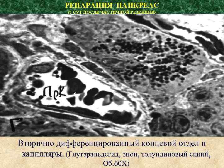 РЕПАРАЦИЯ ПАНКРЕАС (7 СУТ ПОСЛЕ ЧАСТИЧНОЙ РЕЗЕКЦИИ) Вторично дифференцированный концевой отдел и капилляры. (Глутаральдегид,