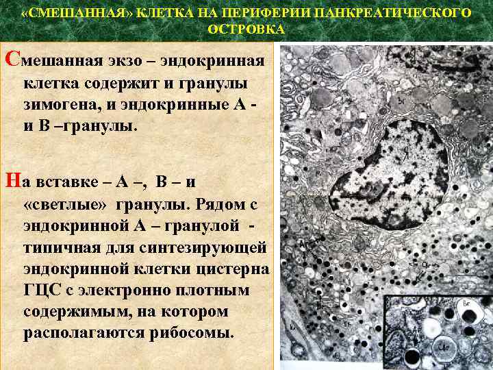  «СМЕШАННАЯ» КЛЕТКА НА ПЕРИФЕРИИ ПАНКРЕАТИЧЕСКОГО ОСТРОВКА Смешанная экзо – эндокринная клетка содержит и