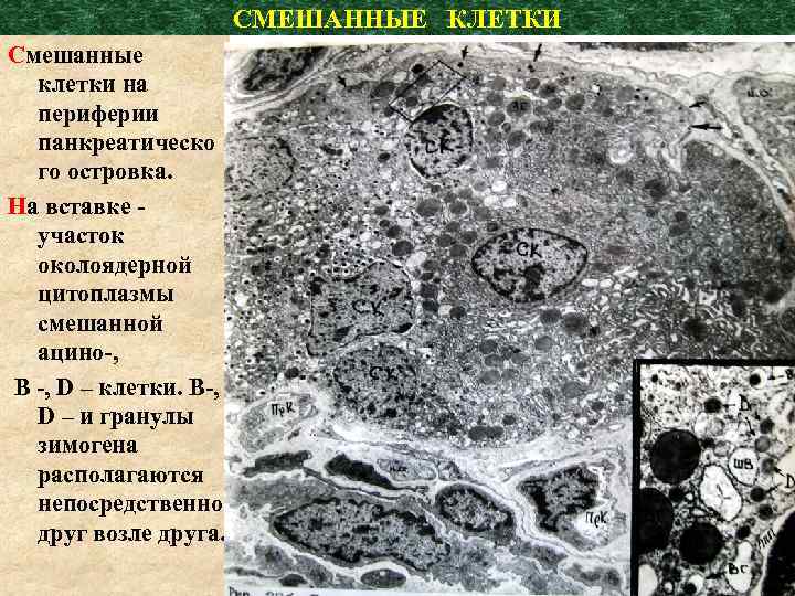 СМЕШАННЫЕ КЛЕТКИ Смешанные клетки на периферии панкреатическо го островка. На вставке - участок околоядерной