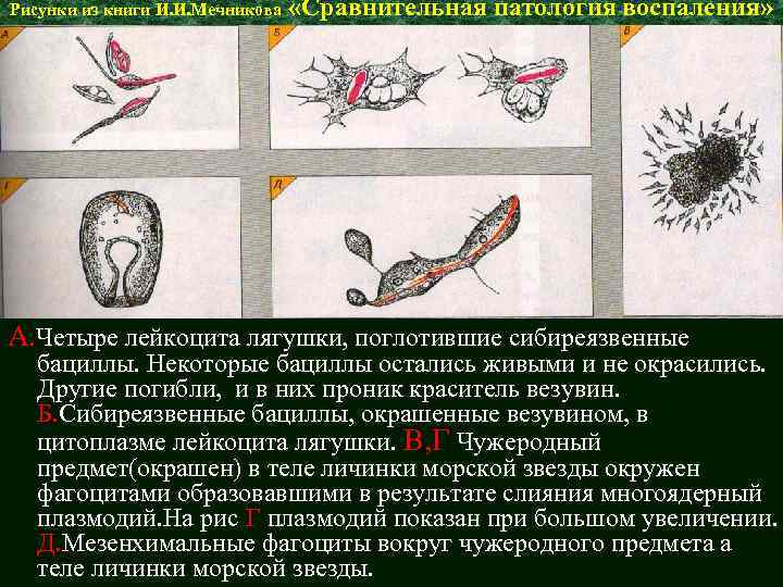 Патология в рисунках