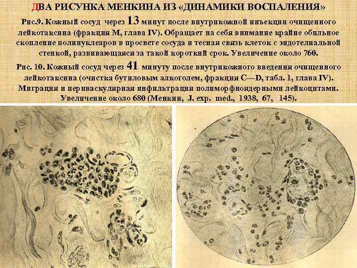 ДВА РИСУНКА МЕНКИНА ИЗ «ДИНАМИКИ ВОСПАЛЕНИЯ» Рис. 9. Кожный сосуд через 13 минут после