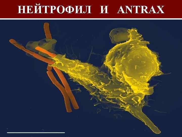 НЕЙТРОФИЛ И ANTRAX 
