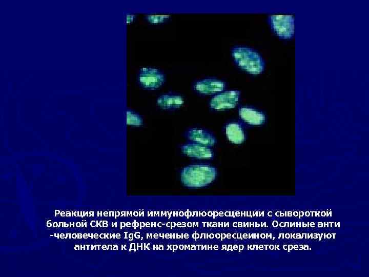 Реакция непрямой иммунофлюоресценции с сывороткой больной СКВ и рефренс-срезом ткани свиньи. Ослиные анти -человеческие