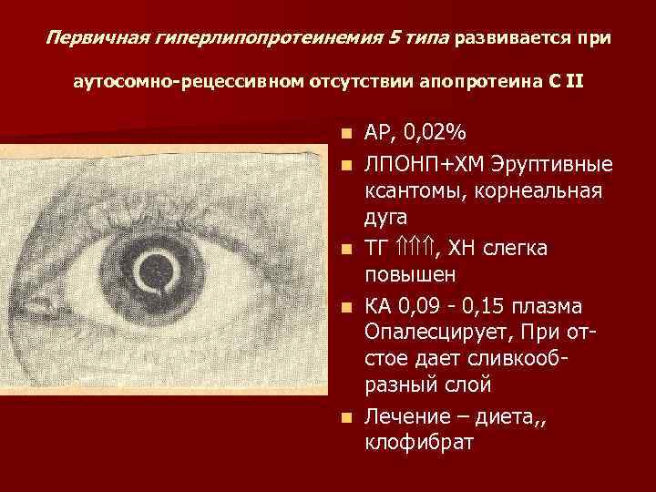 Первичная гиперлипопротеинемия 5 типа развивается при аутосомно рецессивном отсутствии апопротеина С II n n