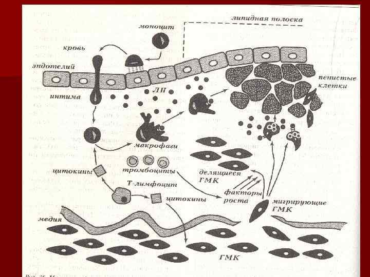 ЛП и атерогенез 