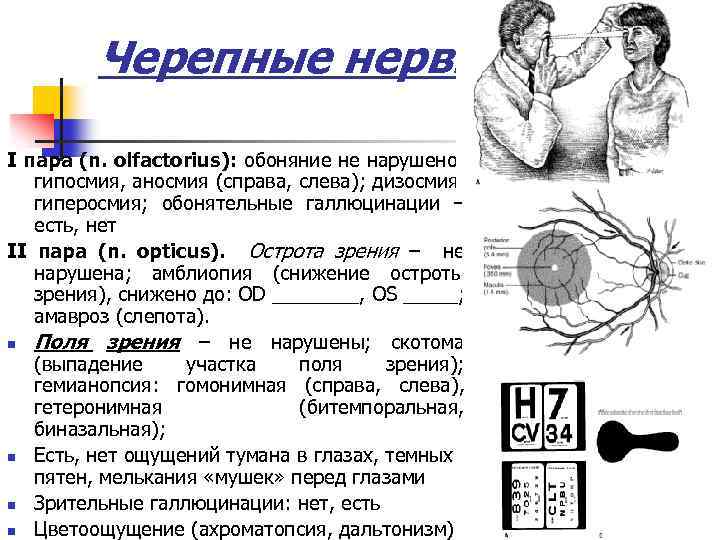 Черепные нервы І пара (n. olfactorius): обоняние не нарушено; гипосмия, аносмия (справа, слева); дизосмия,