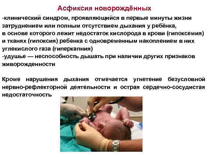 Асфиксия новорождённых -клинический синдром, проявляющийся в первые минуты жизни затруднением или полным отсутствием дыхания