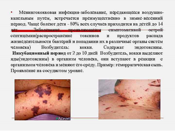  • Менингококковая инфекция-заболевание, передающееся воздушнокапельным путем, встречается преимущественно в зимне-весенний период. Чаще болеют