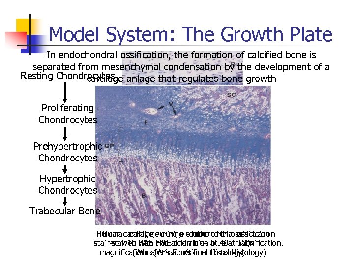 Model System: The Growth Plate In endochondral ossification, the formation of calcified bone is