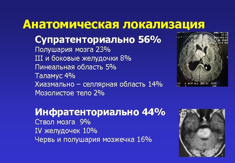 Мр картина единичных супратенториальных очагов