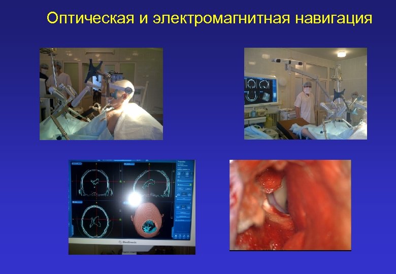Оптическая и электромагнитная навигация 