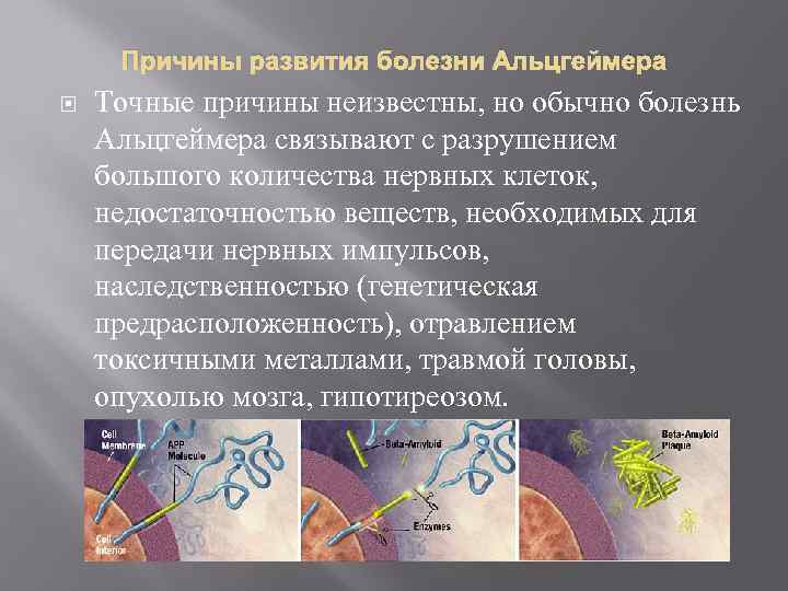 Причины развития болезни Альцгеймера Точные причины неизвестны, но обычно болезнь Альцгеймера связывают с разрушением