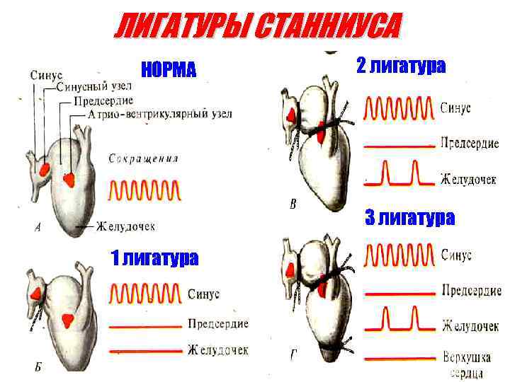 Что такое лигатуры в ворде