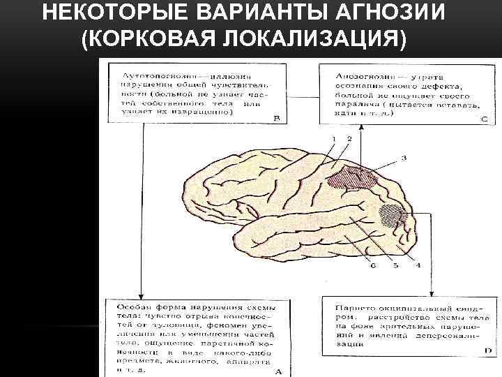 Локализация психических функций в мозге. Агнозии локализация. Зрительная агнозия. Лицевая агнозия локализация. Цветовая агнозия локализация.