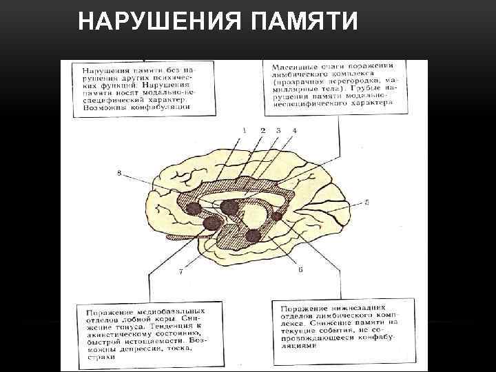 НАРУШЕНИЯ ПАМЯТИ 
