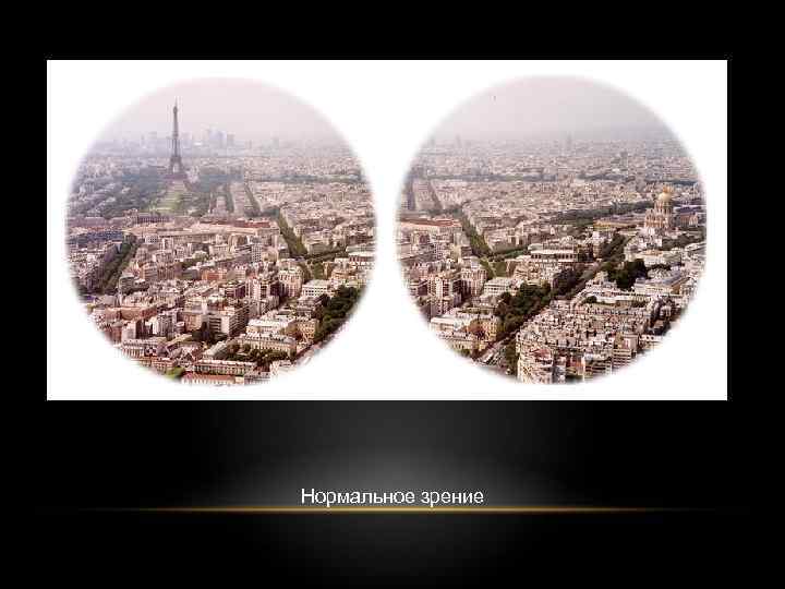 Нормальное зрение 