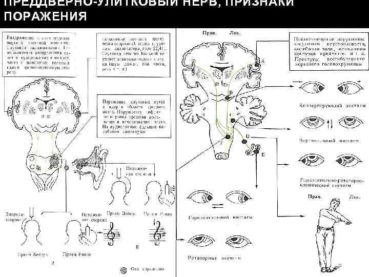 ПРЕДДВЕРНО-УЛИТКОВЫЙ НЕРВ, ПРИЗНАКИ ПОРАЖЕНИЯ 