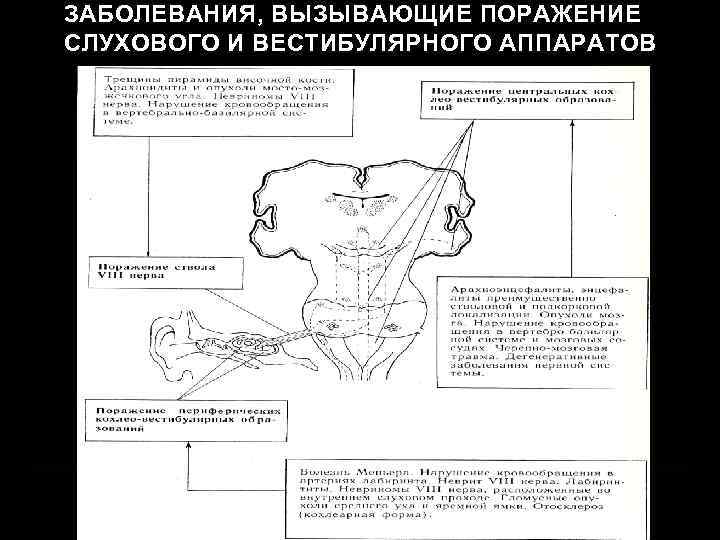 ЗАБОЛЕВАНИЯ, ВЫЗЫВАЮЩИЕ ПОРАЖЕНИЕ СЛУХОВОГО И ВЕСТИБУЛЯРНОГО АППАРАТОВ 
