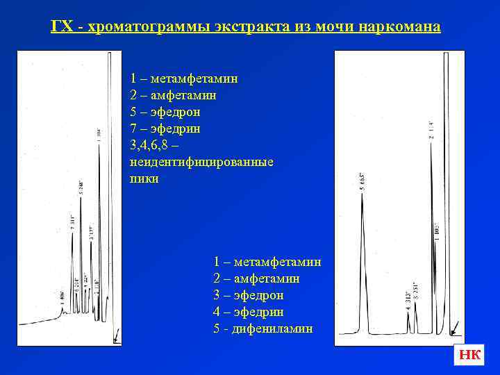 ГХ - хроматограммы экстракта из мочи наркомана 1 – метамфетамин 2 – амфетамин 5