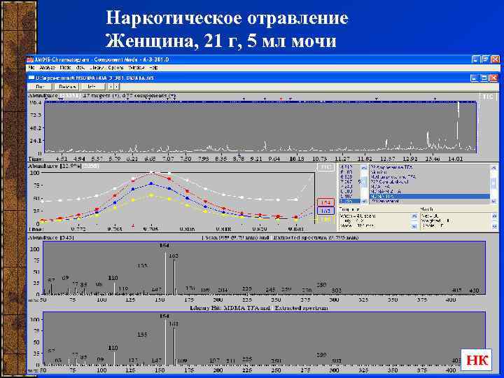 Наркотическое отравление Женщина, 21 г, 5 мл мочи НК 