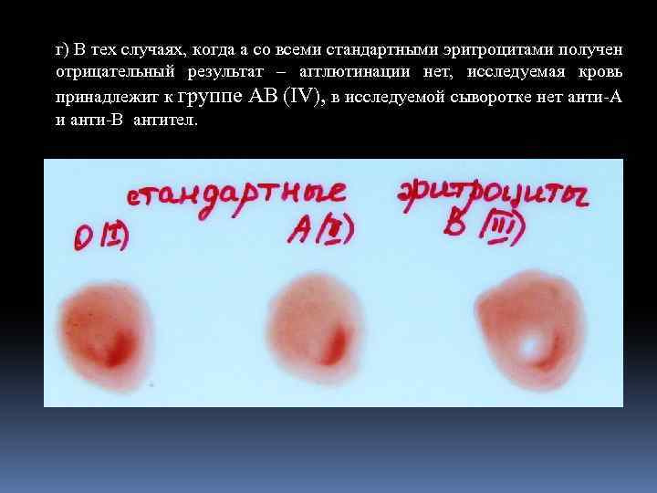 г) В тех случаях, когда а со всеми стандартными эритроцитами получен отрицательный результат –